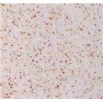 Akrikor Mutfak Tezgahları 5