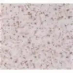 Mermerit Mutfak Tezgahları 2